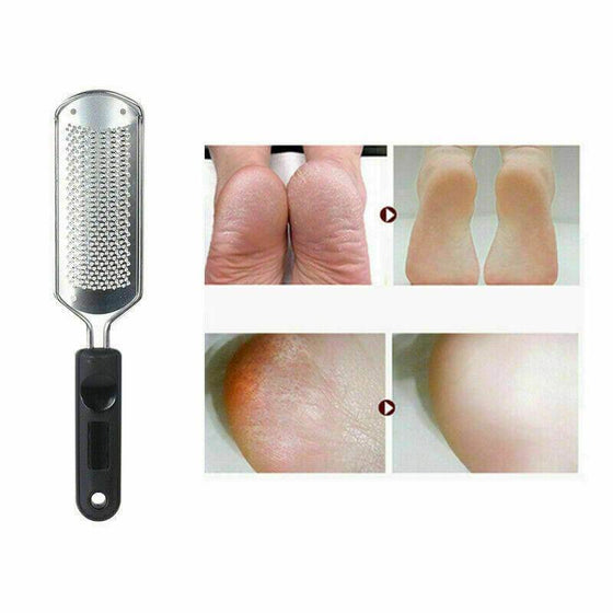 Pro 2 In1 Foot Callus Remover with wavy surface and handle; ideal for smooth, crack-free heels.